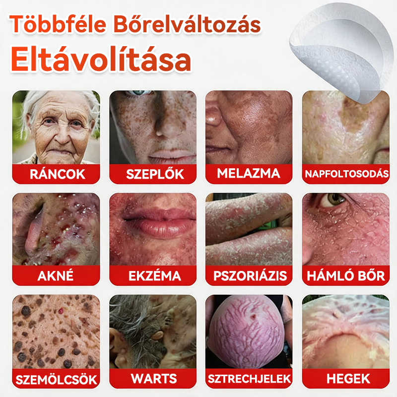 👩🏻‍⚕️GFOUK® ✅Mikrotűs növényi bőrkinövés eltávolító tapasz