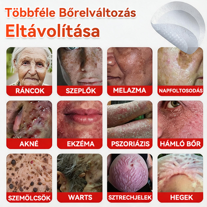 👩🏻‍⚕️GFOUK® ✅Mikrotűs növényi bőrkinövés eltávolító tapasz
