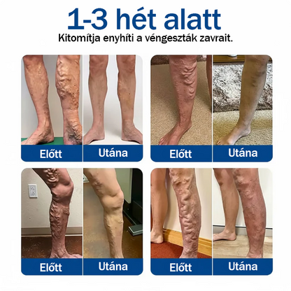 🦵Már csak 5 doboz maradt! További 50%-os kedvezményt kínálunk! Legyen formában és egészséges! Használja ki most az alkalmat, mert jövő évig nem lesz újabb lehetősége.