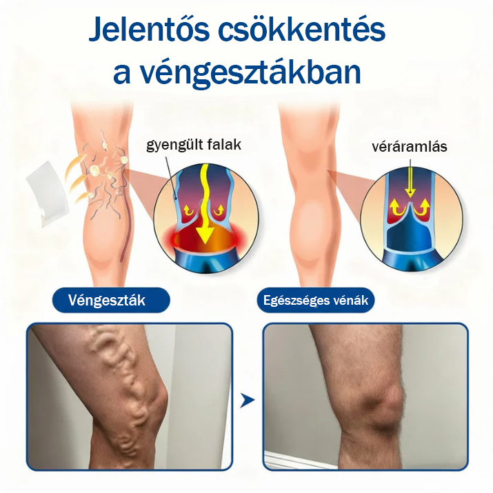 🦵Már csak 5 doboz maradt! További 50%-os kedvezményt kínálunk! Legyen formában és egészséges! Használja ki most az alkalmat, mert jövő évig nem lesz újabb lehetősége.