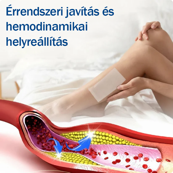 🤩🇭🇺👨‍⚕️✅TAILEDEN® VeinEase Mikrotűs Kezelő Tapasz⚡Azonnali Megkönnyebbülés, Hosszú Távú Eredmények